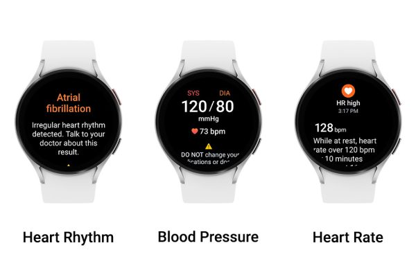 heart rhythm